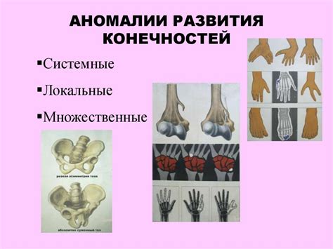 Аномалии развития стопы