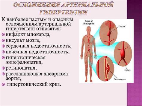 Артериальная гипотензия