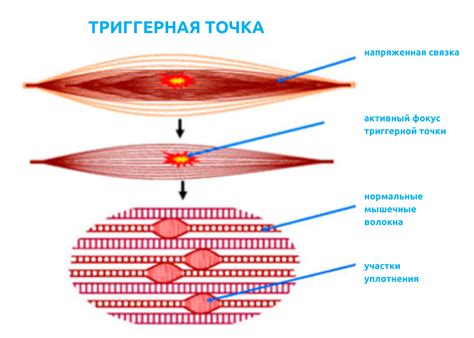 Болевой синдром