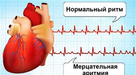 Боли при нарушении ритма сердца