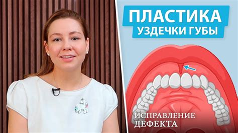 Важность подрезки уздечки верхней губы для здоровья