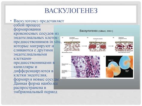 Васкулогенез недоразвитой сетчатки