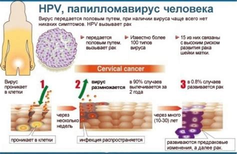 Влияние папилломавируса на организм