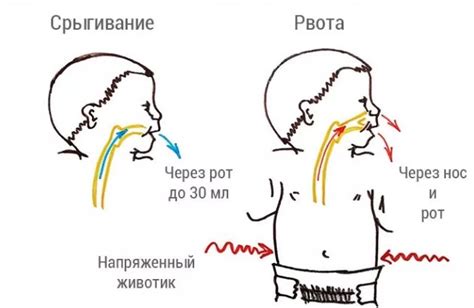 Влияние положения младенца на процесс срыгивания