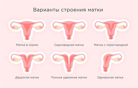 Влияние структуры матки на выделения