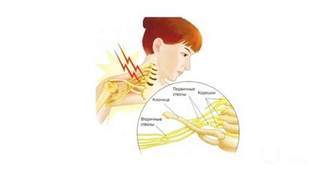 Возможное повреждение нервов