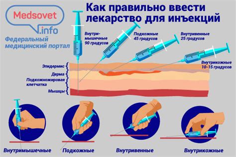 Выбор места и иглы для инъекции