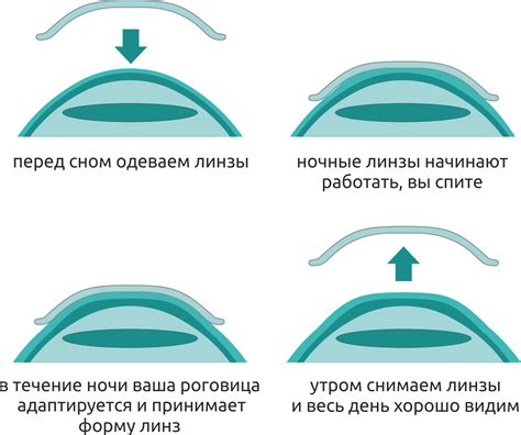 Выбор оптимальных линз