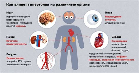 Гипертония и ее проявления