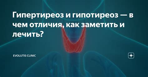 Гипотиреоз как основная причина