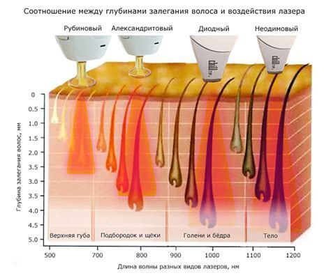 График отрастания волос после проведенной лазерной эпиляции