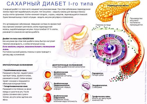 Диабет типа 1: основные характеристики