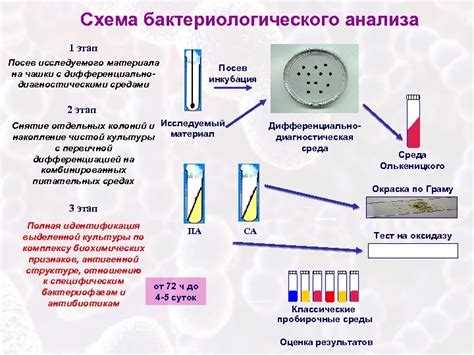 Диагностика и методы определения источника дрожи