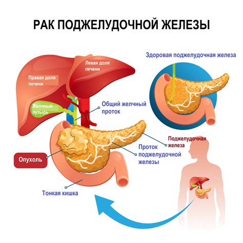 Диагностика и симптомы