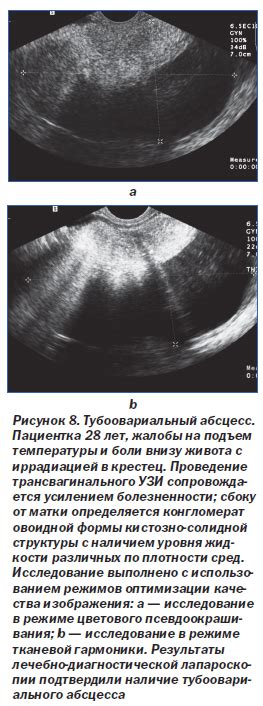 Диагностика лобковых болей