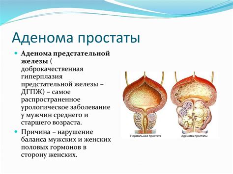 Заболевания органов мочеполовой системы