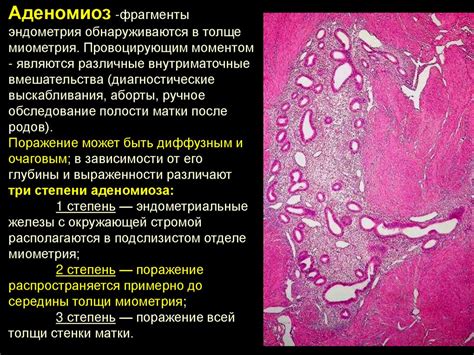 Заболевания половой системы