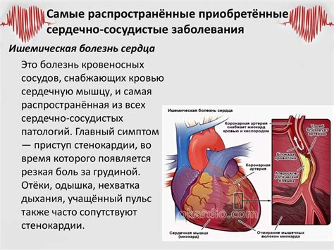 Заболевания сердечно-сосудистой системы: какие проявления могут быть