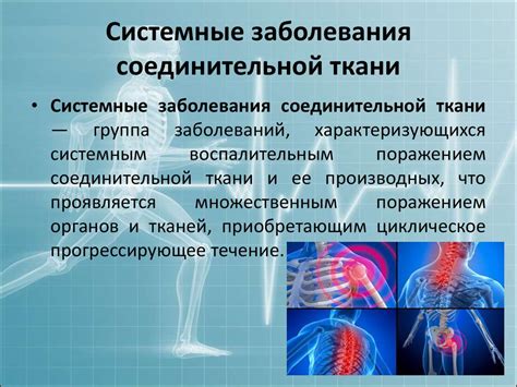 Заболевания соединительной ткани