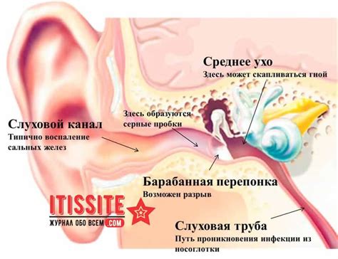 Звон в ушах: симптомы и проявления