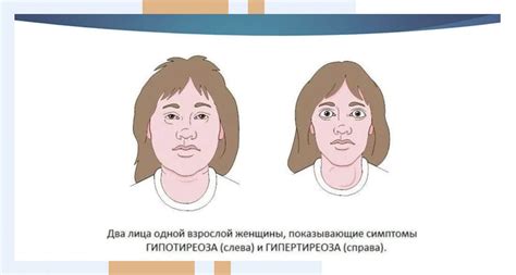 Значение лабораторных анализов в диагностике синдрома Кушинга