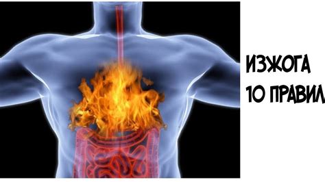 Избавление от изжоги: эффективные методы