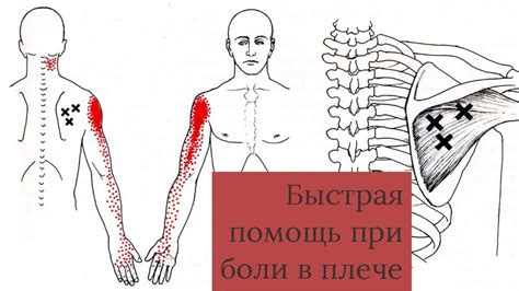 Какие клиники и медицинские центры предлагают квалифицированную помощь при боли в плече?