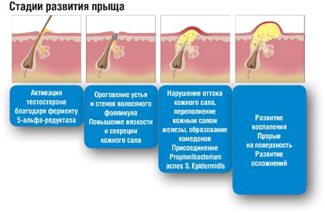 Как избежать инфекции после прыща