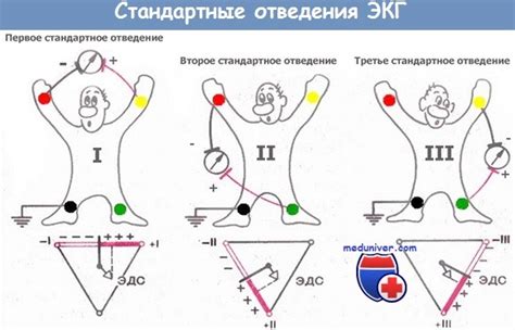 Как правильно выбрать название для ЭКГ