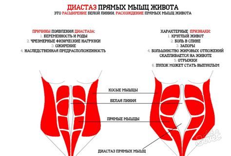 Как правильно проверить диастаз