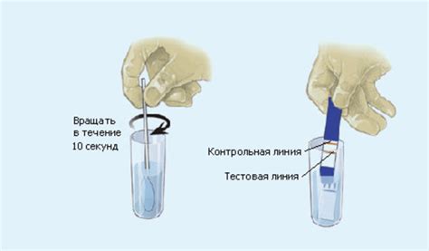 Как предотвратить пролив околоплодных вод?