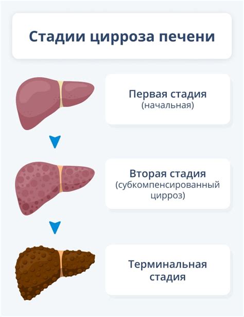 Как распознать зашлакованность печени у женщин?