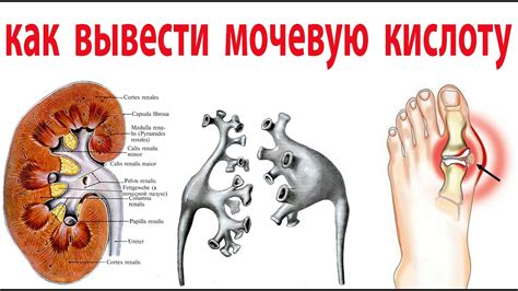 Как черный чай помогает снизить уровень мочевой кислоты