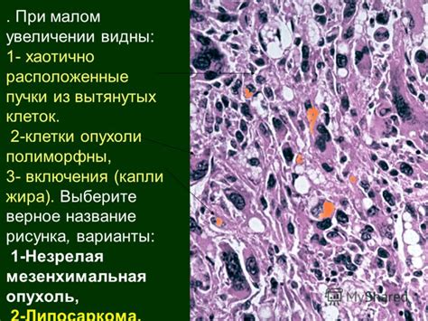 Клетки опухоли проявление компенсации