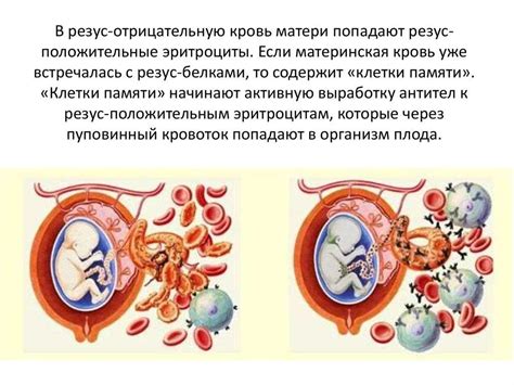 Конфликт резус-факторов между матерью и плодом