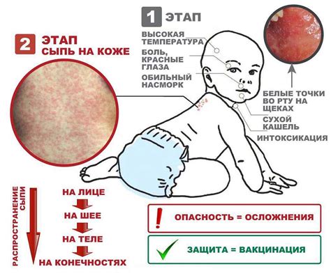 Лечение сыпи у детей