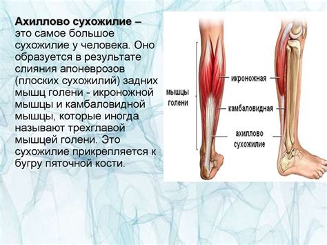 Медикаментозное лечение укороченного ахиллова сухожилия