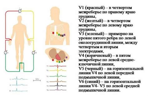 Методика проведения ЭКГ