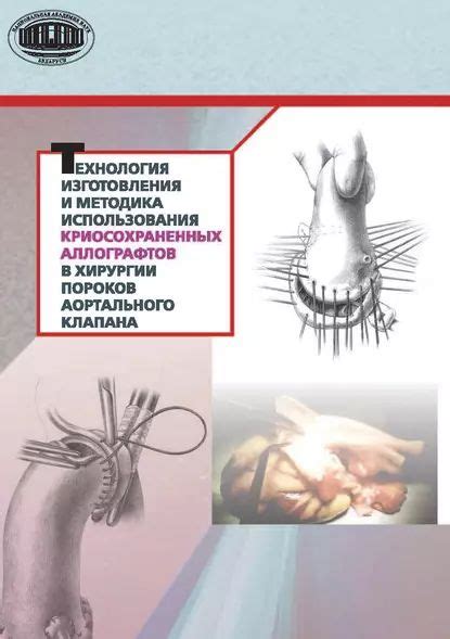 Методики использования в хирургии