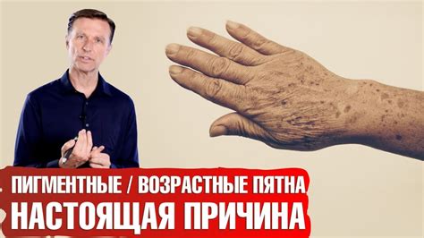 Методы борьбы со старческими пятнами