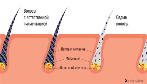 Механизмы появления седины