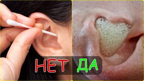 Микротравмы при чистке ушей