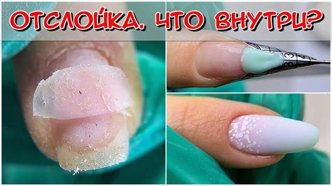 Нанесение гель-лака на треснутый ноготь