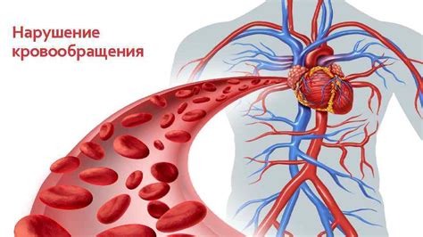 Нарушение кровообращения в плаценте