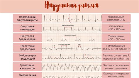 Нарушение ритма кишечника