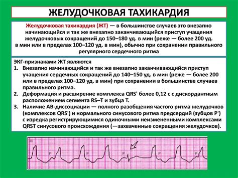 Нарушение сердечного ритма: