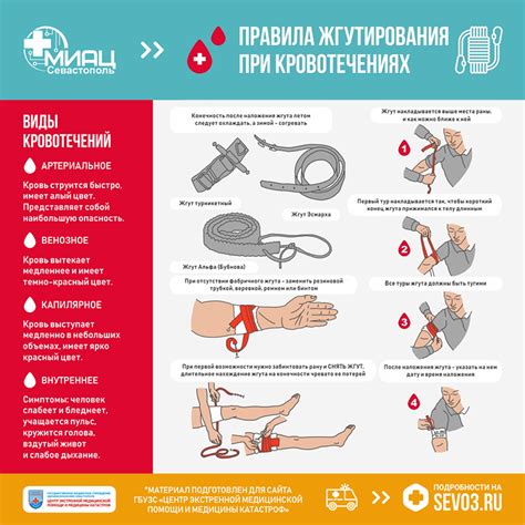 Недоступность специального средства остановки кровотечения