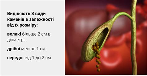 Немедикаментозные методы борьбы с болью в желчном пузыре