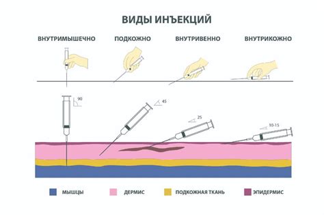 Неправильный угол наклона иглы