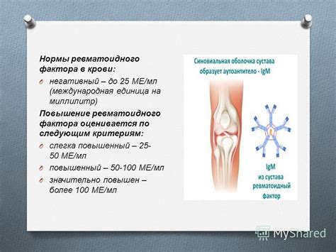 Норма ревматоидного фактора в крови